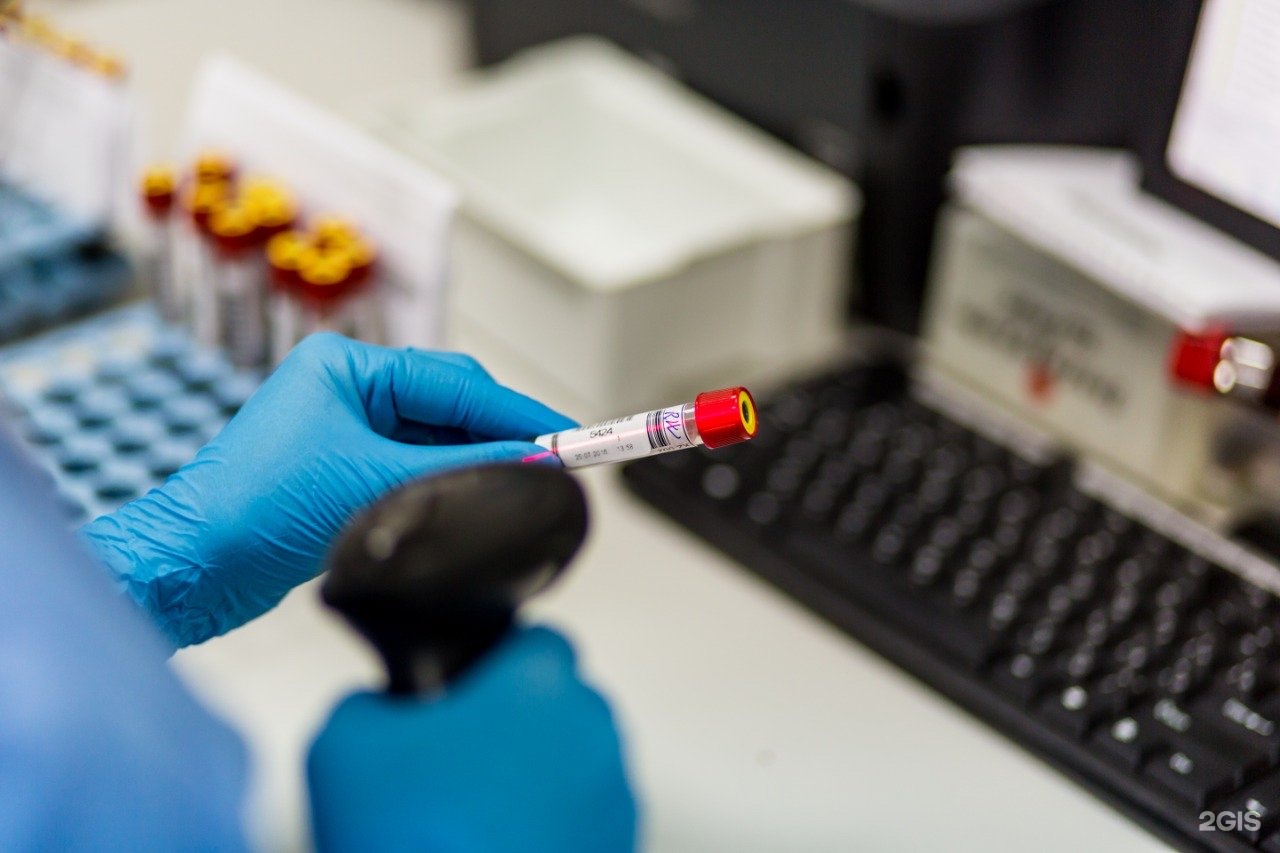 Исследование кровли. Лабораторные методы диагностики карбункула. Лабдиагностика. Aqua лаборатория. Лабдиагностика пермь закамск маршала рыбалко 89 врачи.