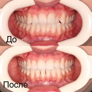 Фото от владельца Здоровые зубы, стоматологическая клиника