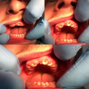 Фото от владельца Smile Dent, зуботехническая лаборатория