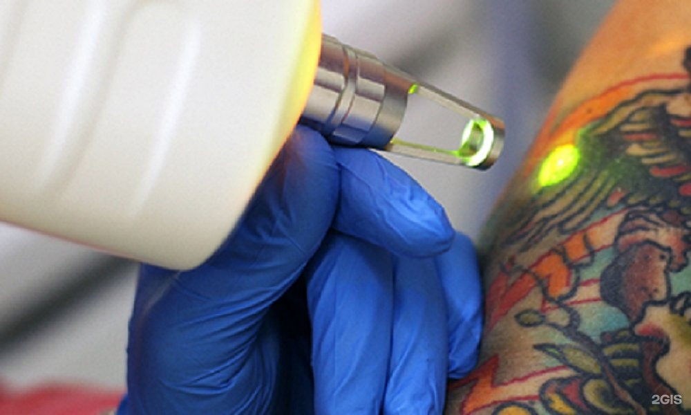 Лазер Для Удаления Тату Цена