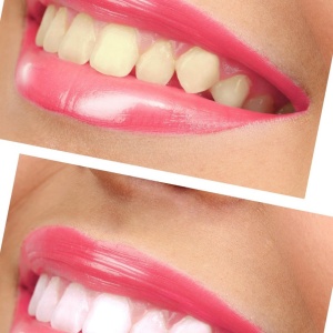 Фото от владельца White & Smile, студия косметического отбеливания зубов