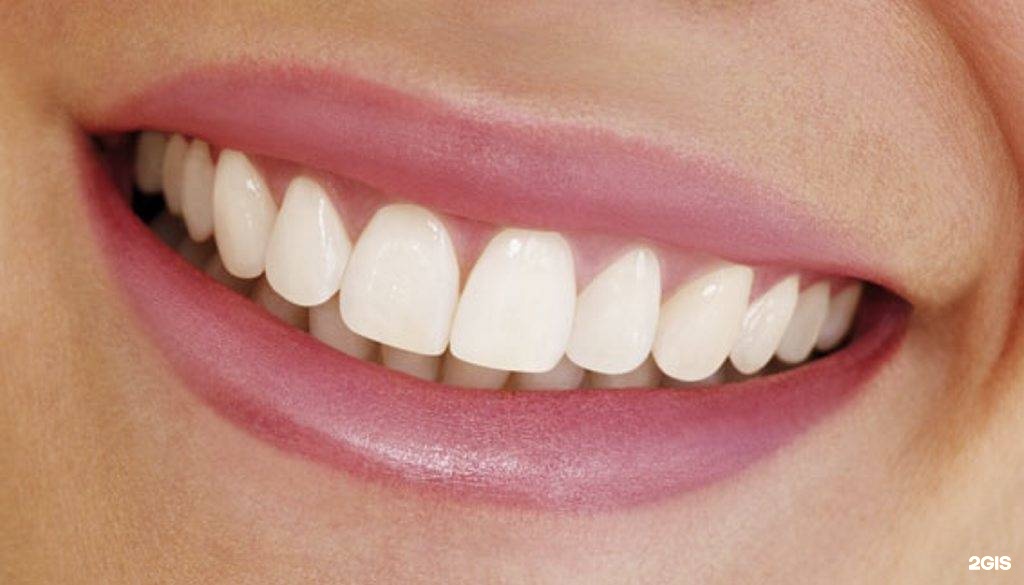 Фотоотбеливание зубов Томск Таджикский современные стоматология томск
